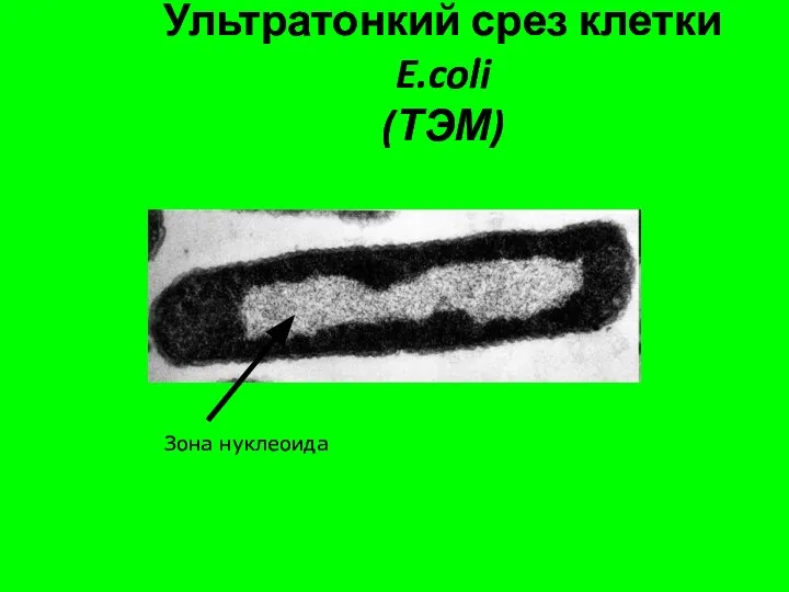 Ультратонкий срез клетки E.coli (ТЭМ) Зона нуклеоида