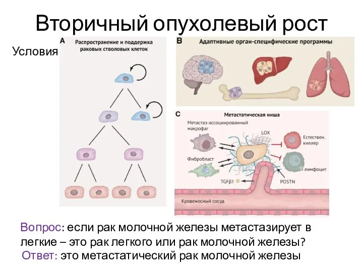 Вторичный опухолевый рост Вопрос: если рак молочной железы метастазирует в легкие