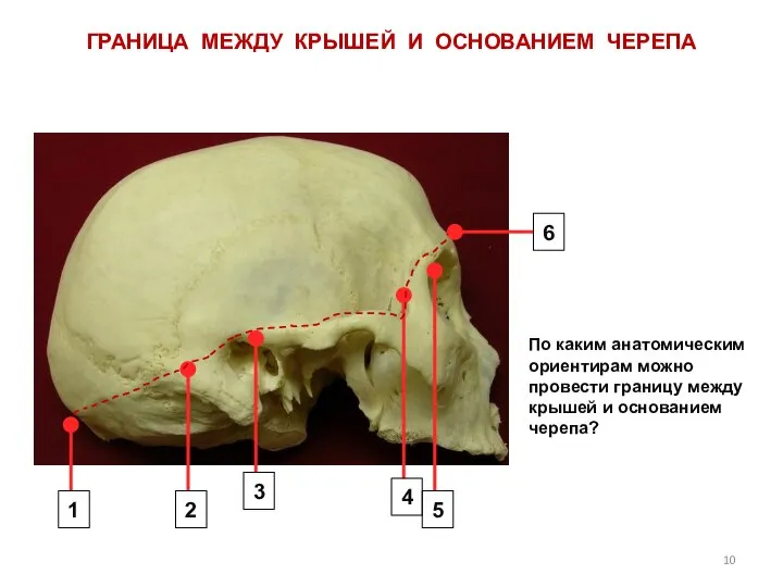 ГРАНИЦА МЕЖДУ КРЫШЕЙ И ОСНОВАНИЕМ ЧЕРЕПА По каким анатомическим ориентирам можно