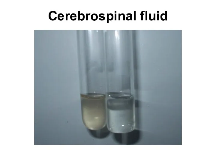 Cerebrospinal fluid