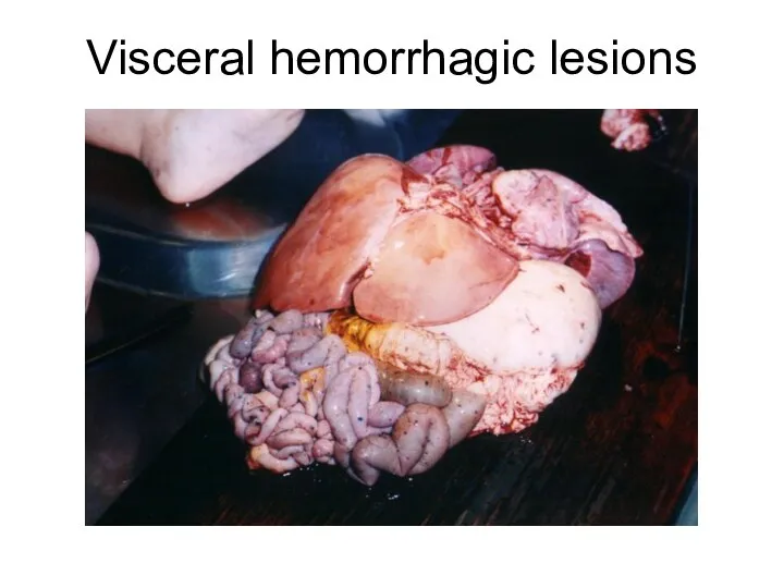 Visceral hemorrhagic lesions