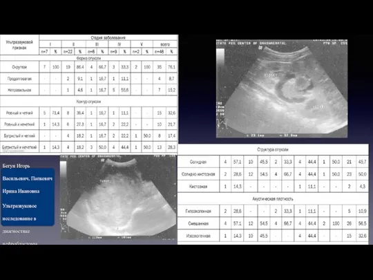 Источник: Бегун Игорь Васильевич, Папкевич Ирина Ивановна Ультразвуковое исследование в диагностике нефробластомы