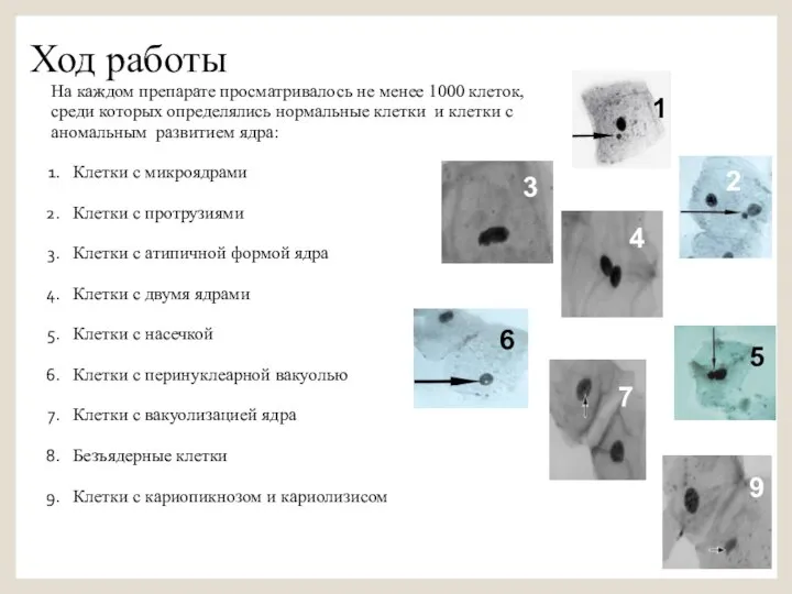 Ход работы На каждом препарате просматривалось не менее 1000 клеток, среди