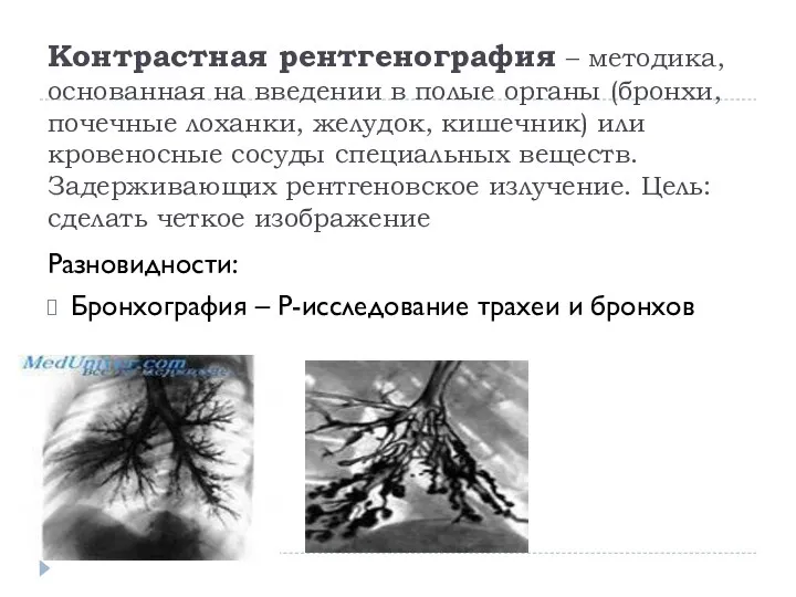 Контрастная рентгенография – методика, основанная на введении в полые органы (бронхи,