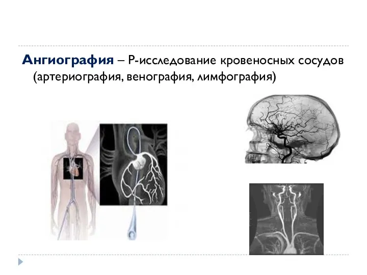 Ангиография – Р-исследование кровеносных сосудов (артериография, венография, лимфография)