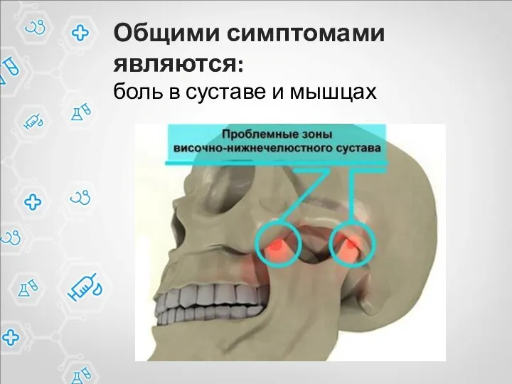 Общими симптомами являются: боль в суставе и мышцах