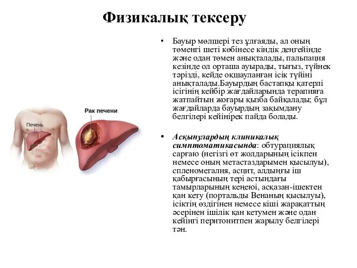 Физикалық тексеру Бауыр мөлшері тез ұлғаяды, ал оның төменгі шеті көбінесе