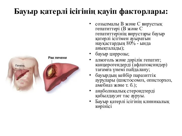 Бауыр қатерлі ісігінің қауіп факторлары: созылмалы В және С вирустық гепатиттері