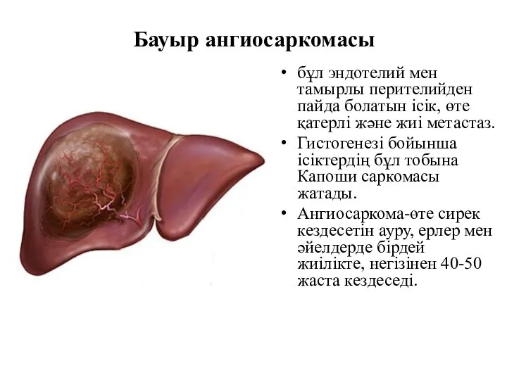 Бауыр ангиосаркомасы бұл эндотелий мен тамырлы перителийден пайда болатын ісік, өте