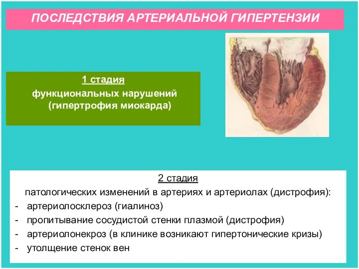 1 стадия функциональных нарушений (гипертрофия миокарда) 2 стадия патологических изменений в