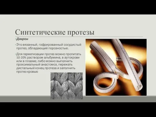 Синтетические протезы Дакрон Это вязанный, гофрированный сосудистый протез, обладающий порозностью. Для