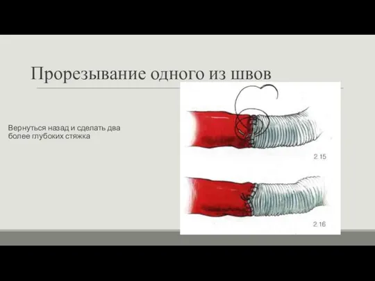 Прорезывание одного из швов Вернуться назад и сделать два более глубоких стяжка