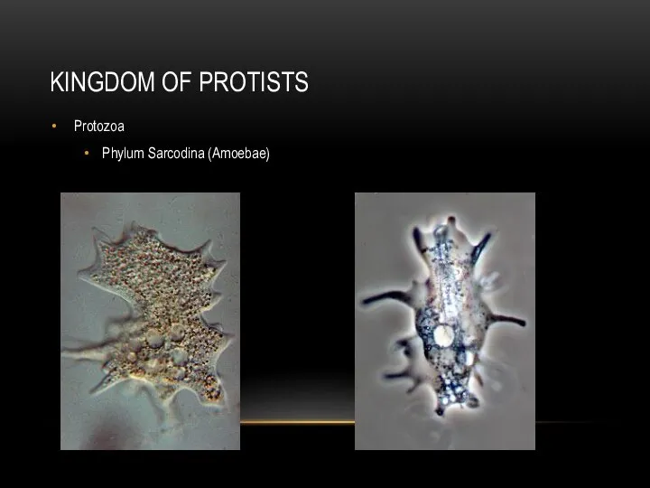 KINGDOM OF PROTISTS Protozoa Phylum Sarcodina (Amoebae)