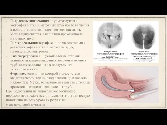 Гидросальпингоскопия – ультразвуковая эхография матки и маточных труб после введения в