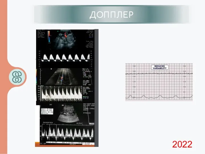 ИЦН ДОППЛЕР 2022