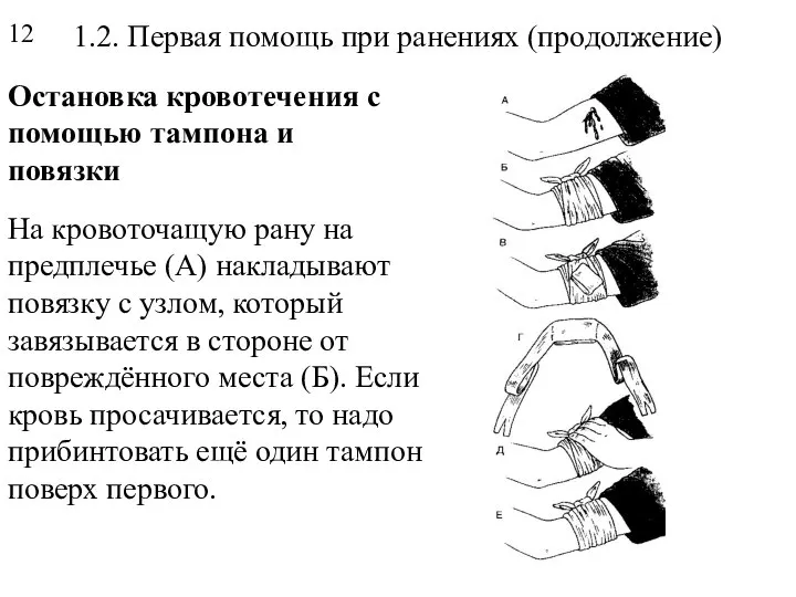 1.2. Первая помощь при ранениях (продолжение) Остановка кровотечения с помощью тампона