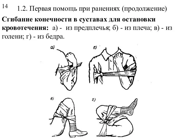 1.2. Первая помощь при ранениях (продолжение) Сгибание конечности в суставах для