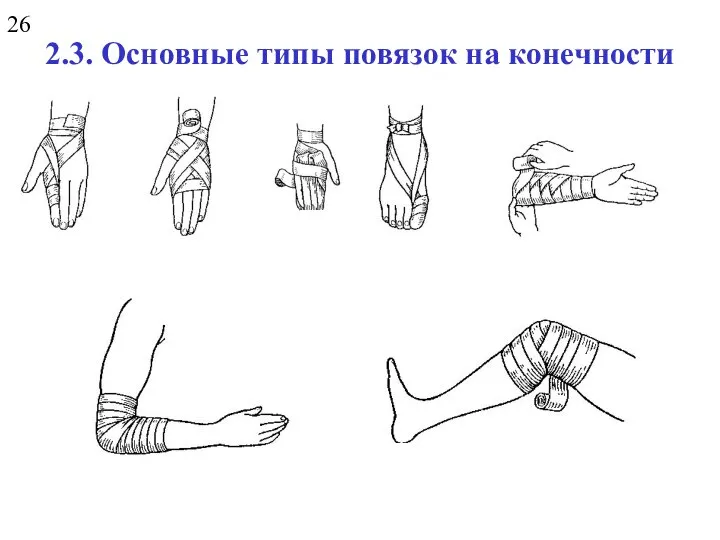 2.3. Основные типы повязок на конечности 26