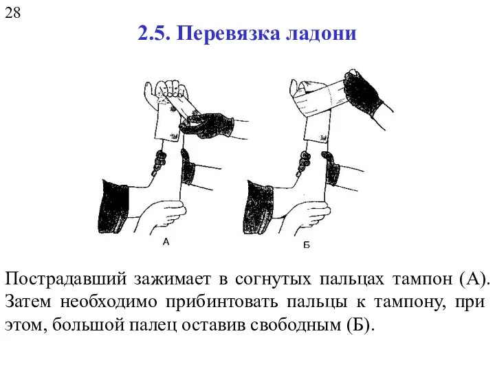 2.5. Перевязка ладони Пострадавший зажимает в согнутых пальцах тампон (А). Затем