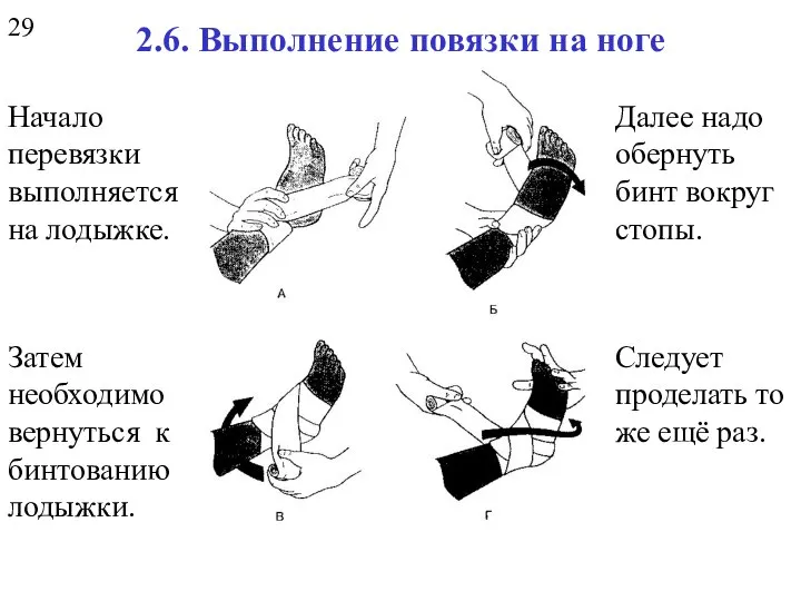 2.6. Выполнение повязки на ноге Начало перевязки выполняется на лодыжке. Далее