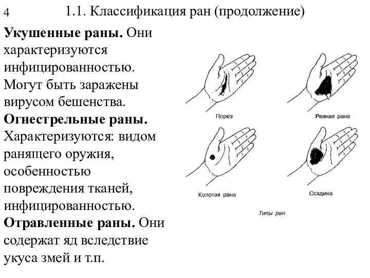 1.1. Классификация ран (продолжение) Укушенные раны. Они характеризуются инфицированностью. Могут быть