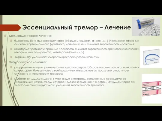 Эссенциальный тремор – Лечение Медикаментозное лечение: блокаторы бета-адренорецепторов (обзидан, индерал, анаприлин)