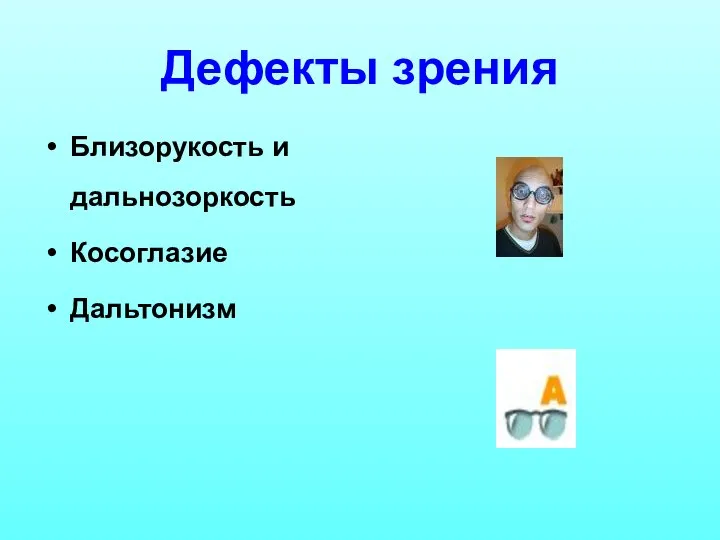 Дефекты зрения Близорукость и дальнозоркость Косоглазие Дальтонизм