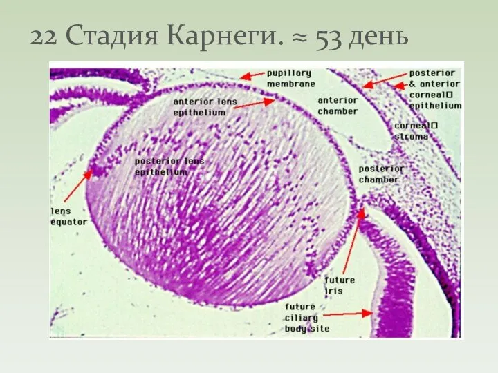 22 Стадия Карнеги. ≈ 53 день