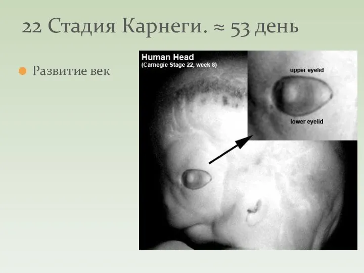 Развитие век 22 Стадия Карнеги. ≈ 53 день