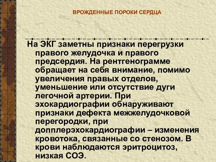 ВРОЖДЕННЫЕ ПОРОКИ СЕРДЦА На ЭКГ заметны признаки перегрузки правого желудочка и