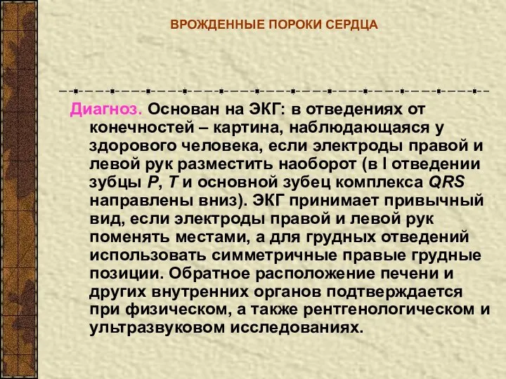 ВРОЖДЕННЫЕ ПОРОКИ СЕРДЦА Диагноз. Основан на ЭКГ: в отведениях от конечностей