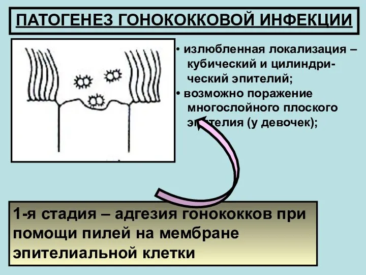 1-я стадия – адгезия гонококков при помощи пилей на мембране эпителиальной