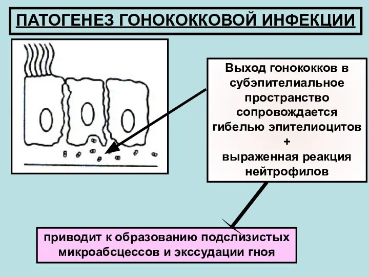 ПАТОГЕНЕЗ ГОНОКОККОВОЙ ИНФЕКЦИИ Выход гонококков в субэпителиальное пространство сопровождается гибелью эпителиоцитов