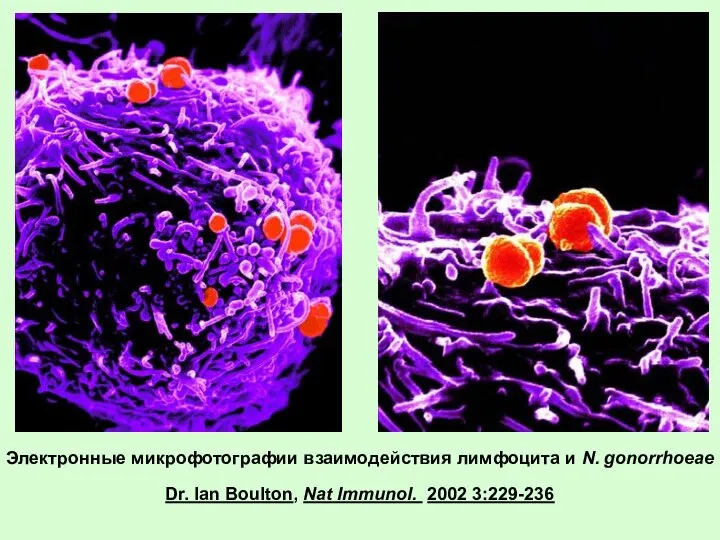 Электронные микрофотографии взаимодействия лимфоцита и N. gonorrhoeae Dr. Ian Boulton, Nat Immunol. 2002 3:229-236