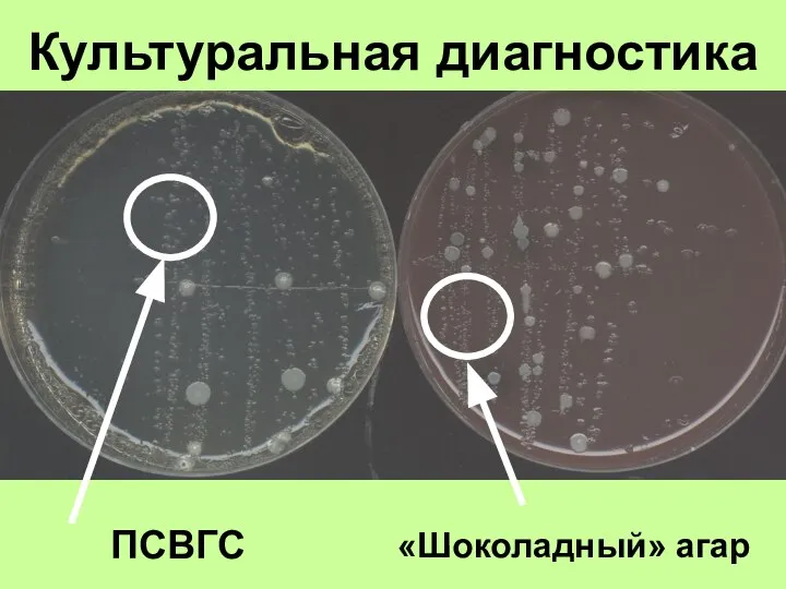 Культуральная диагностика «Шоколадный» агар ПСВГС