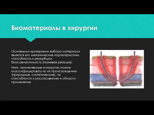 Биоматериалы в хирургии Основными критериями выбора материала являются его механические характеристики,