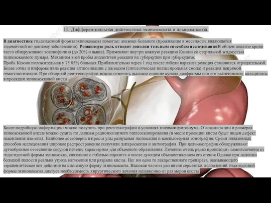 11. Дифференциальная диагностика эхинококкоза и альвеококкоза. В диагностике гидатидозной формы эхинококкоза