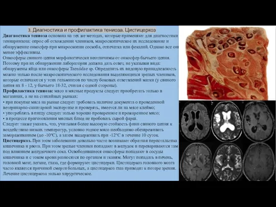 3. Диагностика и профилактика тениоза. Цистицеркоз Диагностика тениоза основана на тех