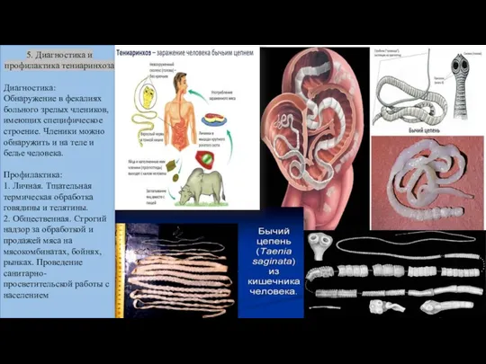 5. Диагностика и профилактика тениаринхоза Диагностика: Обнаружение в фекалиях больного зрелых