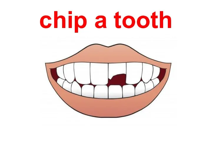 chip a tooth