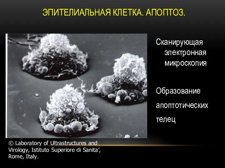 ЭПИТЕЛИАЛЬНАЯ КЛЕТКА. АПОПТОЗ. Сканирующая электронная микроскопия Образование апоптотических телец © Laboratory