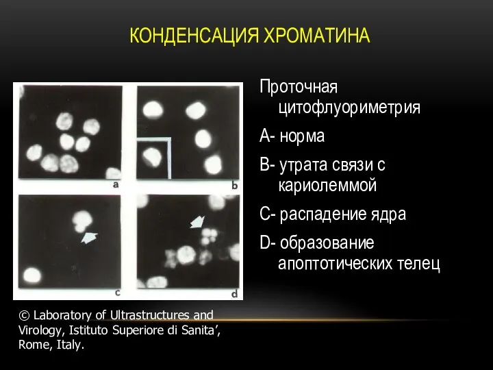 КОНДЕНСАЦИЯ ХРОМАТИНА Проточная цитофлуориметрия A- норма B- утрата связи с кариолеммой