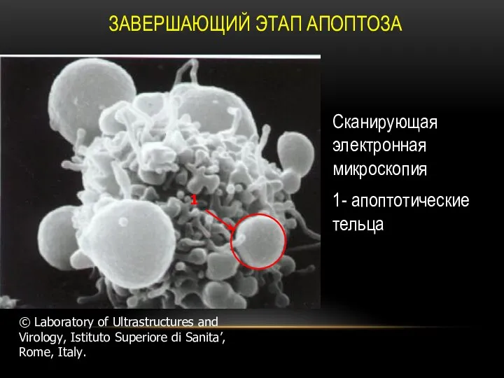 ЗАВЕРШАЮЩИЙ ЭТАП АПОПТОЗА Сканирующая электронная микроскопия 1- апоптотические тельца 1 ©