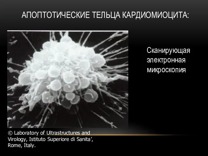 АПОПТОТИЧЕСКИЕ ТЕЛЬЦА КАРДИОМИОЦИТА: Сканирующая электронная микроскопия © Laboratory of Ultrastructures and