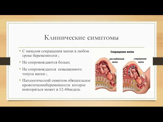 Клинические симптомы С началом сокращения матки в любом сроке беременности ;