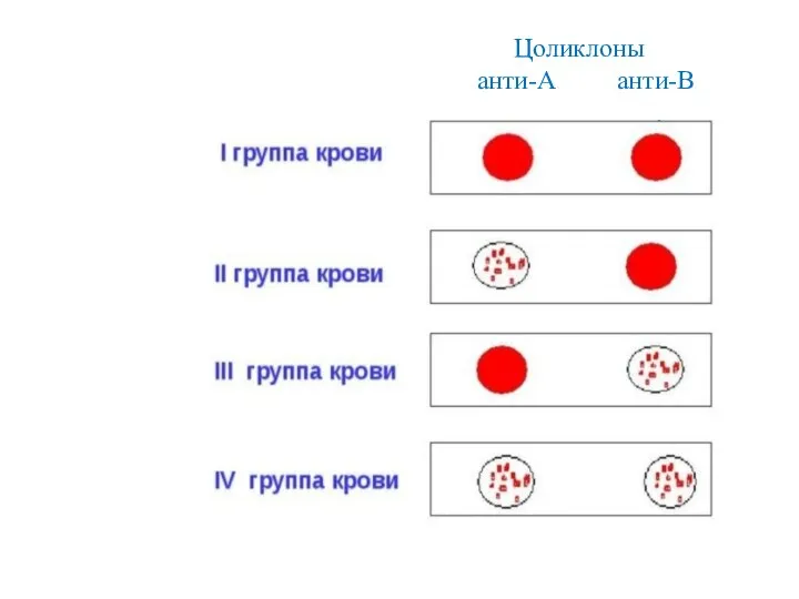 Цоликлоны анти-А анти-В