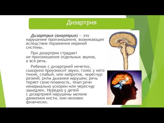 Дизартрия Дизартрия (анартрия) — это нарушение произношения, возникающее вследствие поражения нервной