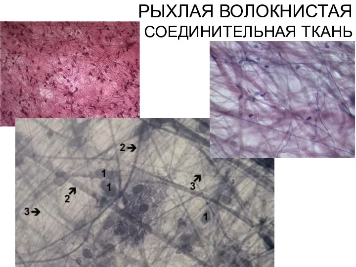 РЫХЛАЯ ВОЛОКНИСТАЯ СОЕДИНИТЕЛЬНАЯ ТКАНЬ