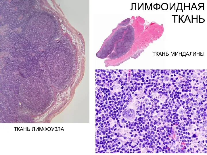 ЛИМФОИДНАЯ ТКАНЬ ТКАНЬ ЛИМФОУЗЛА ТКАНЬ МИНДАЛИНЫ