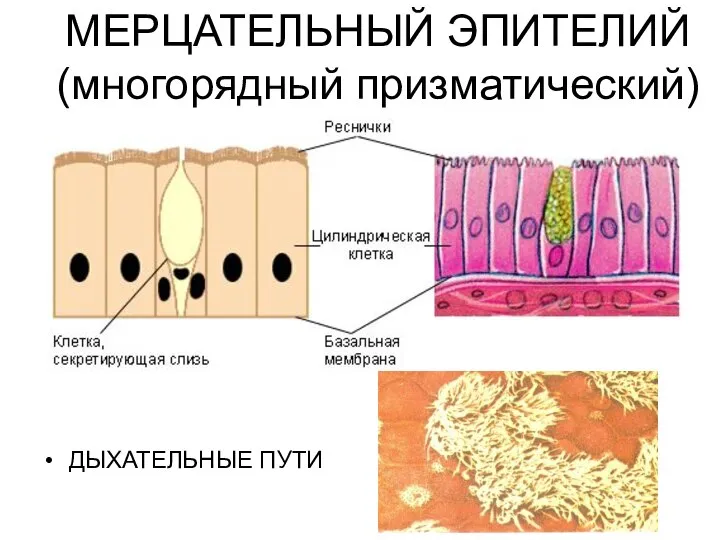 МЕРЦАТЕЛЬНЫЙ ЭПИТЕЛИЙ (многорядный призматический) ДЫХАТЕЛЬНЫЕ ПУТИ